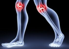 Sedemên pêşveçûna arthrosisê kokê