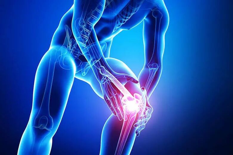 nîşanên arthrosis